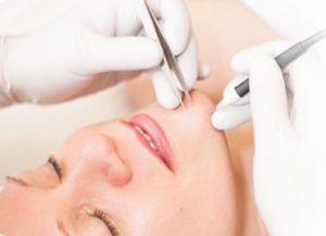 Electrolysis Hair Removal in Cary, NC